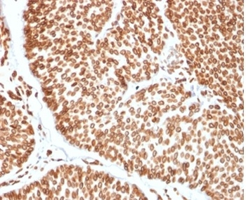 TCF4 Antibody