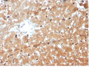 HP Antibody