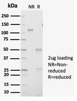 Recombinant Aldo-keto Reductase Family 1 Member B1 (Adrenal Marker) Antibody