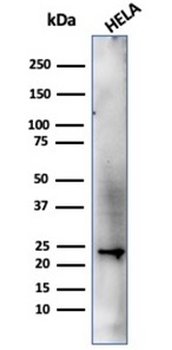 CBFB / PEBP2β Antibody
