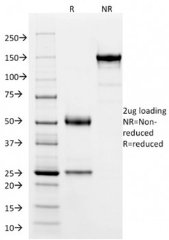 SOX9 / SRY-box 9 Antibody