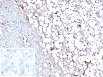 Recombinant STAT6 (Solitary Fibrous Tumor Marker) Antibody