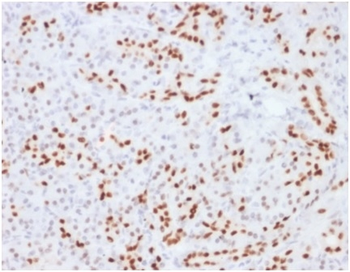 SOX9 / SRY-box 9 Antibody