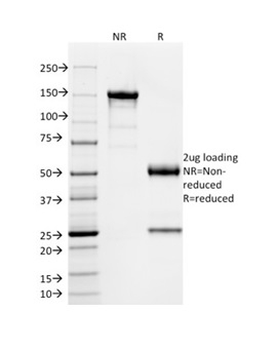 SOX9 / SRY-box 9 Antibody