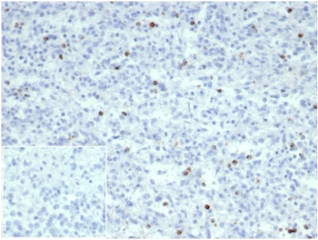 Recombinant Perforin-1 (Pore Forming Protein) (Apoptosis Marker) Antibody
