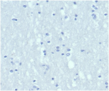 KRT6A Antibody