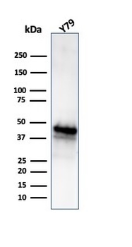 Glutamine Synthetase / GLUL Antibody