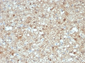 S100B (Astrocyte and Melanoma Marker) Antibody