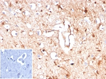 S100B (Astrocyte and Melanoma Marker) Antibody
