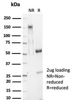Recombinant EpCAM / CD326 (Epithelial Marker) Antibody