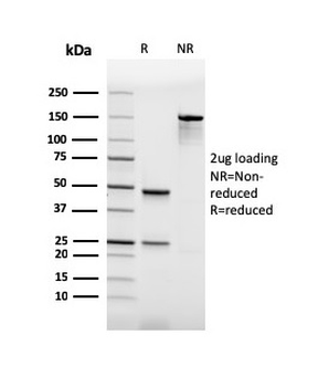 Recombinant PU.1 (SPI-1) (B-Cell Marker) Antibody