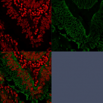 Ep-CAM / CD326 (Extracellular Domain) (Epithelial Marker) Antibody