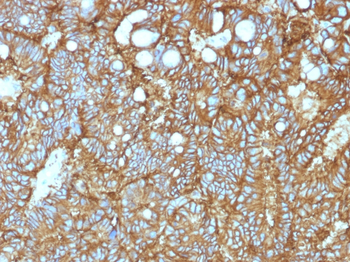 Ep-CAM / CD326 (Extracellular Domain) (Epithelial Marker) Antibody