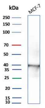 Ep-CAM / CD326 (Extracellular Domain) (Epithelial Marker) Antibody