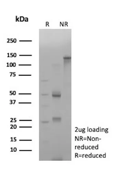 Recombinant Catenin, beta Antibody