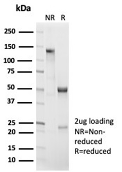 Recombinant Catenin, beta (CTNNB1) Antibody