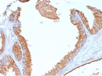 Glypican-3 (GPC3) (Hepatocellular Carcinoma Marker) Antibody