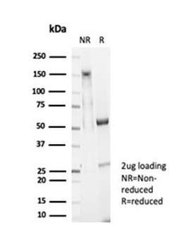 Glypican-3 (GPC3) (Hepatocellular Carcinoma Marker) Antibody
