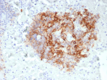 CD35 / CR1 (Follicular Dendritic Cell Marker) Antibody