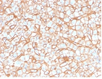 APOB Antibody