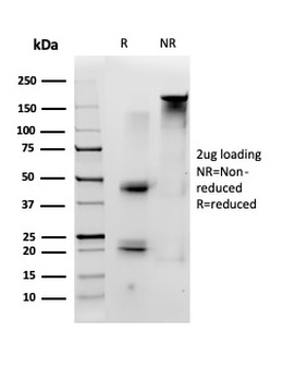 ID1 (Inhibitor of DNA-binding) (Transcription Factor) Antibody