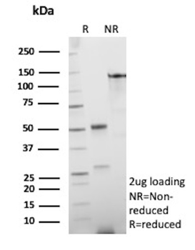 Recombinant EpCAM / CD326 (Epithelial Marker) Antibody