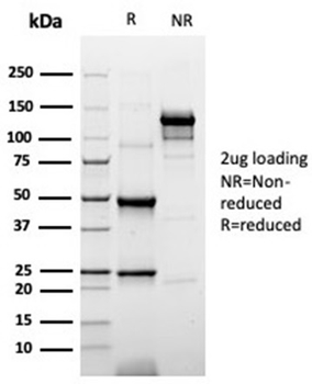 Recombinant Cytokeratin 20 (KRT20) (Colorectal Epithelial Marker) Antibody