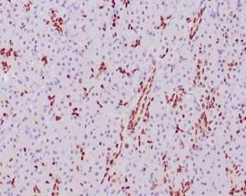 SOX9 / SRY-box 9 Antibody