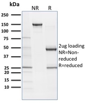 SOX9 / SRY-box 9 Antibody