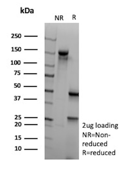 Glutamine Synthetase / GLUL Antibody