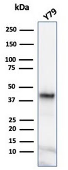 Glutamine Synthetase / GLUL Antibody
