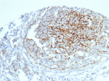 CD35 / CR1 (Follicular Dendritic Cell Marker) Antibody