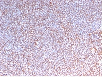 Recombinant ALK (Anaplastic Lymphoma Kinase) / CD246 Antibody