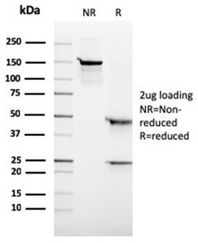 Recombinant ALK (Anaplastic Lymphoma Kinase) / CD246 Antibody