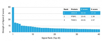 AMACR / p504S (Prostate Cancer Marker) Antibody