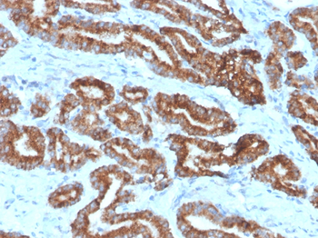 AMACR / p504S (Prostate Cancer Marker) Antibody