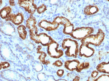 AMACR / p504S (Prostate Cancer Marker) Antibody