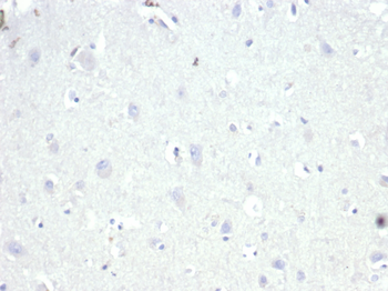 AMACR / p504S (Prostate Cancer Marker) Antibody