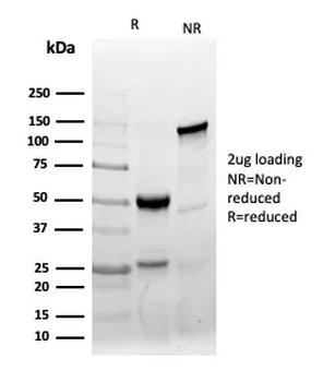 AMACR / p504S (Prostate Cancer Marker) Antibody
