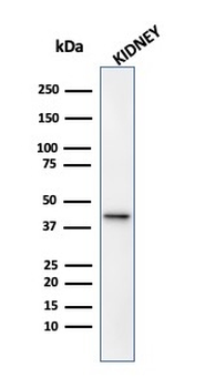 AMACR / p504S (Prostate Cancer Marker) Antibody