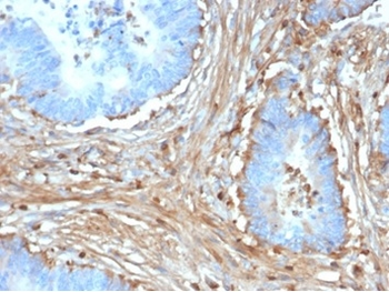 Fibrillin-1 (FBN1) (Marfan Syndrome Marker) Antibody