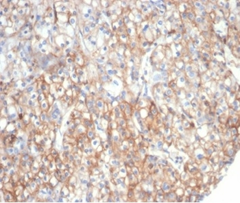 Fibrillin-1 (FBN1) (Marfan Syndrome Marker) Antibody