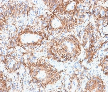 FBN1 Antibody