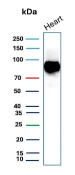 CD36 (Platelet & Microvessel Marker) Antibody