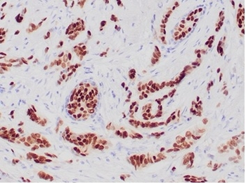 Recombinant Progesterone Receptor (Marker of Progestin Dependence) Antibody