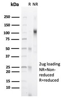 Recombinant Progesterone Receptor (Marker of Progestin Dependence) Antibody
