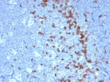 PDCD1 / PD1 / CD279 (Programmed Cell Death 1) Antibody