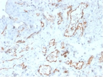 CD31 / PECAM-1 (Endothelial Cell Marker) Antibody