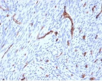 CD31 / PECAM-1 (Endothelial Cell Marker) Antibody