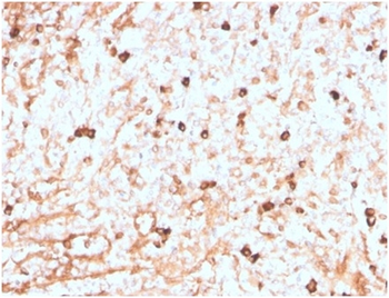 Recombinant Lambda Light Chain (B-Cell Marker) Antibody